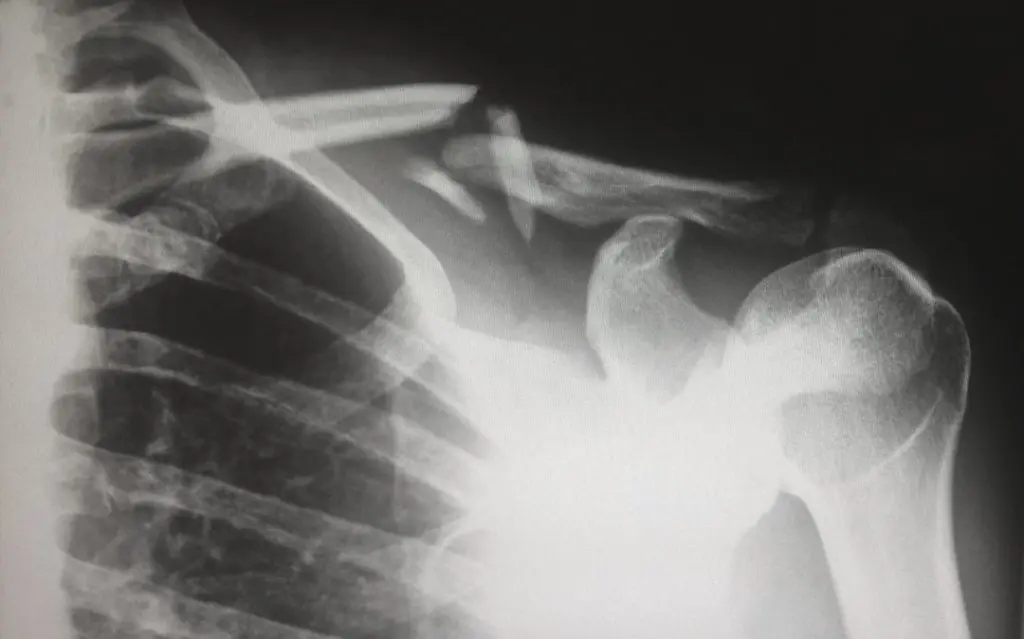 So, You Need an X-Ray?: Here’s What to Expect During an X-Ray - Coastal ...